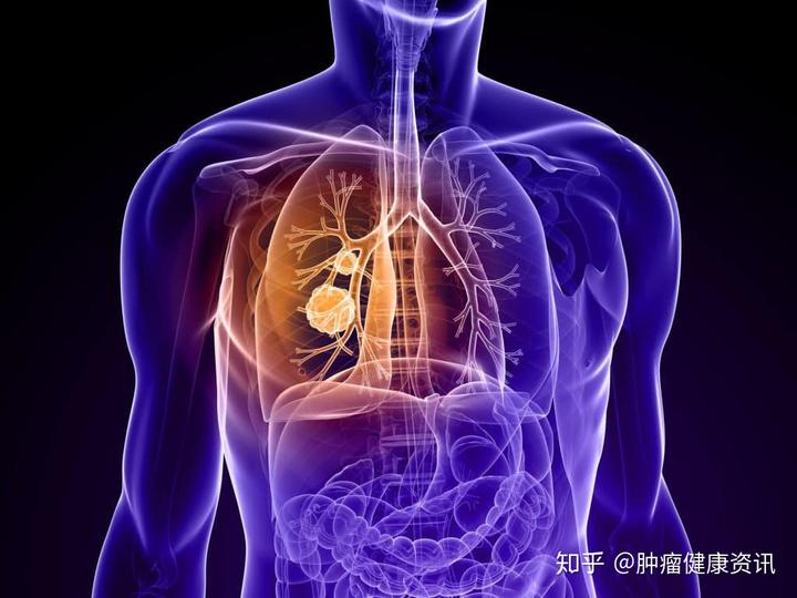 奥硒维康是什么药