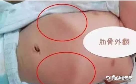 8个月宝宝需要补钙吗