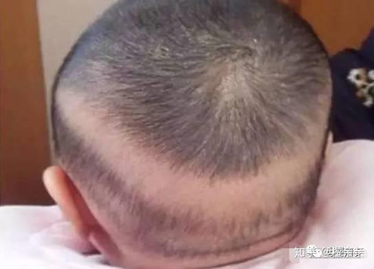 8个月宝宝需要补钙吗