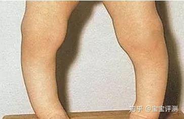 三个月宝宝怎么补钙