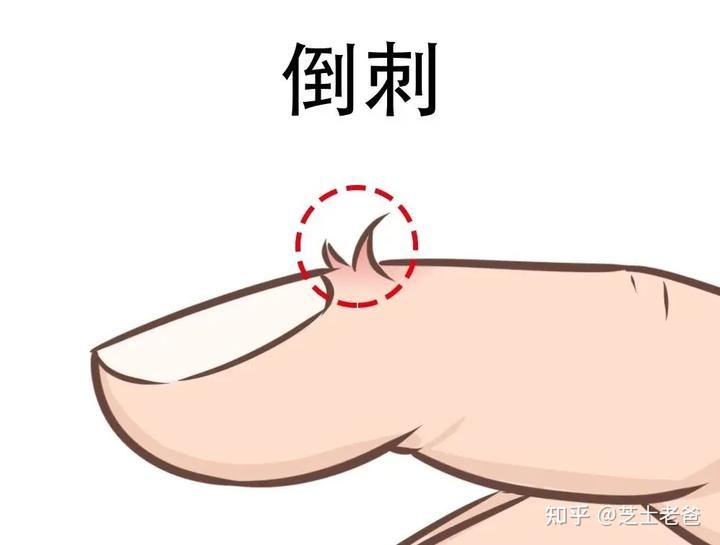 缺锌缺硒吃锌晒宝