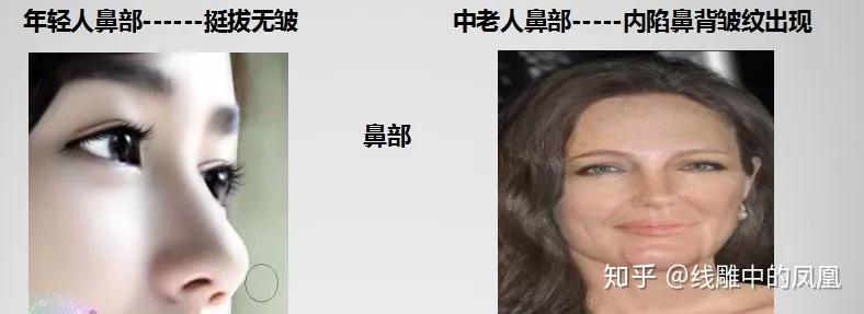 补钙面部会衰老得慢些吗