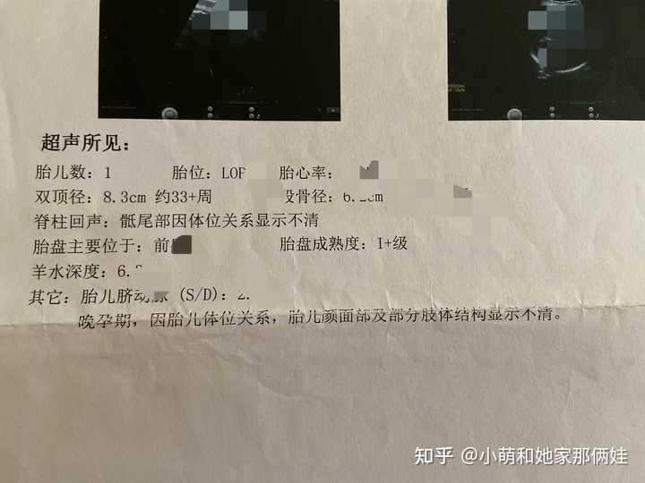 孕晚期还需要补钙吗
