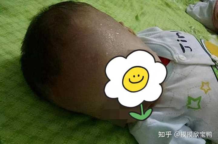 孩子补钙什么牌子好