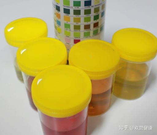 吃锌硒宝小便很黄