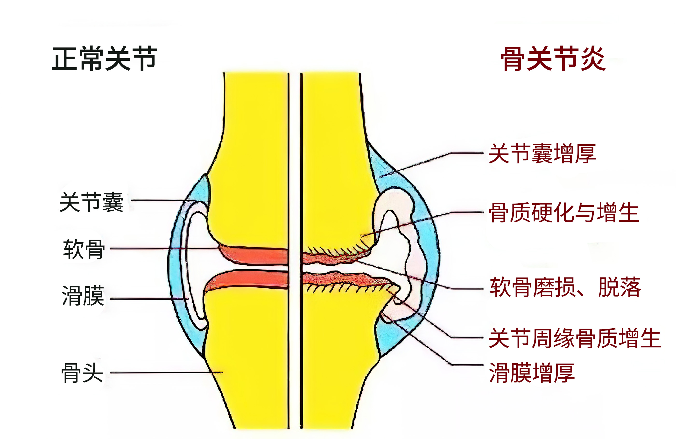 氨糖能补钙吗