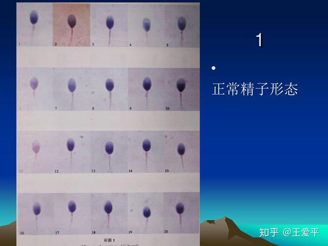 男士男宝备孕锌硒