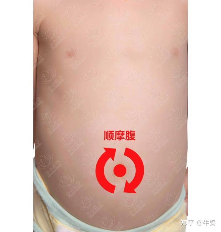 补铁容易便秘吗