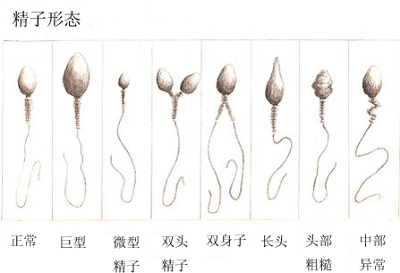 锌硒宝的原料是啥