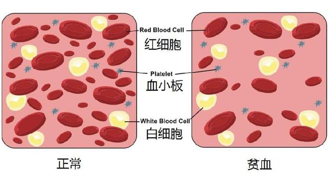 地贫不能补铁