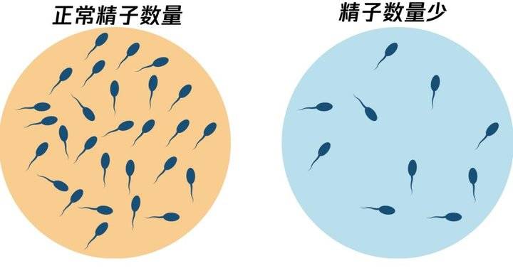 精子活力低补锌补硒