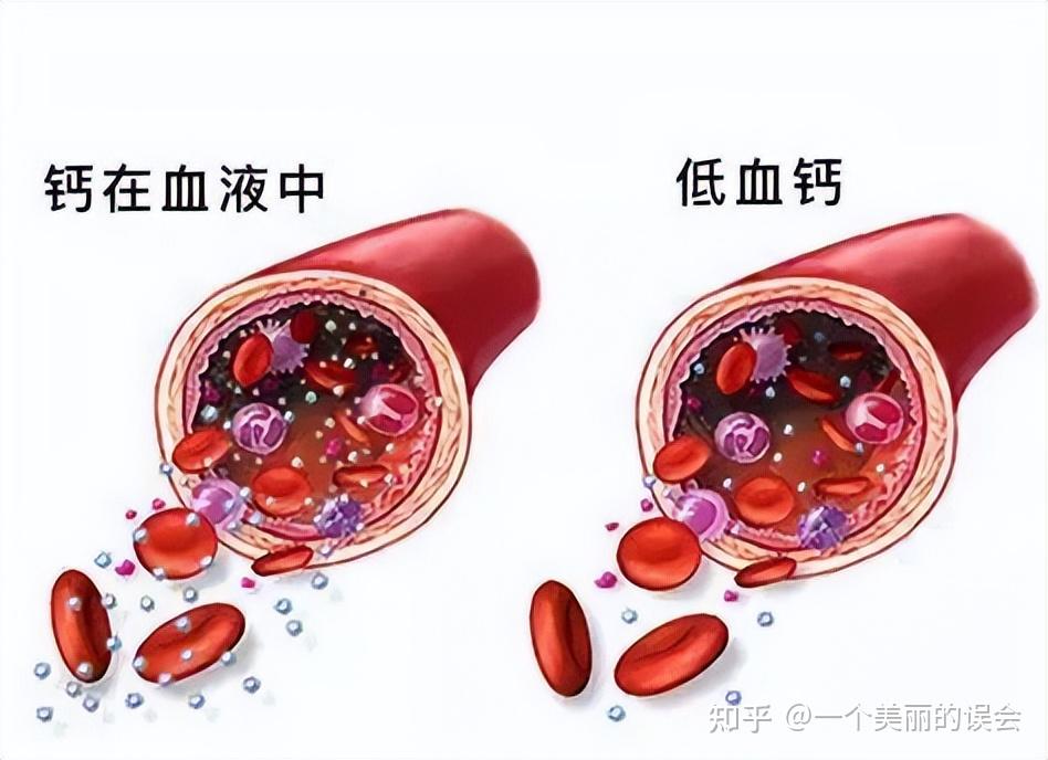 哪些食物补钙效果好
