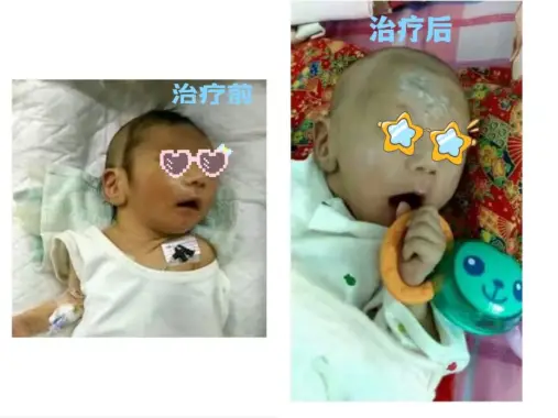 怎么补铁