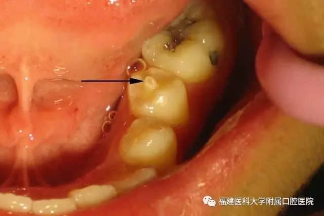八个月宝宝怎么补钙
