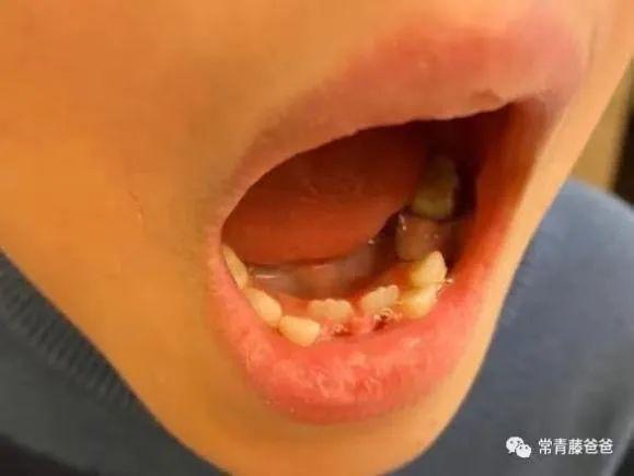 八个月宝宝怎么补钙
