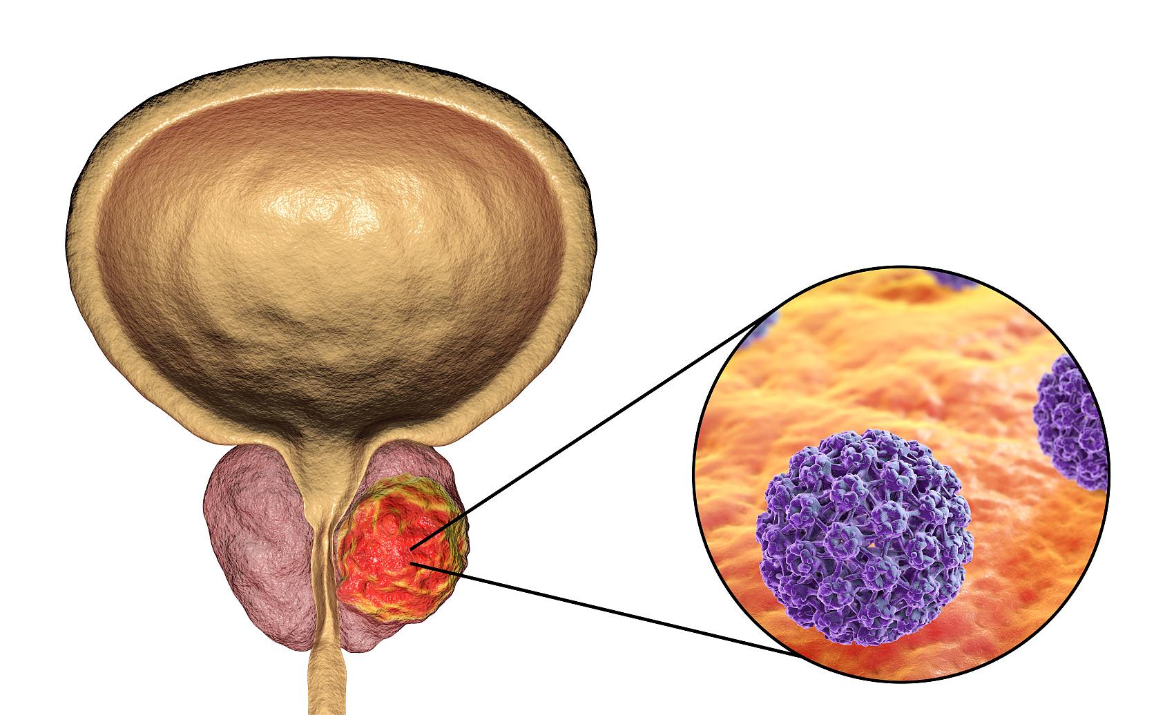 补硒能治hpv 吗