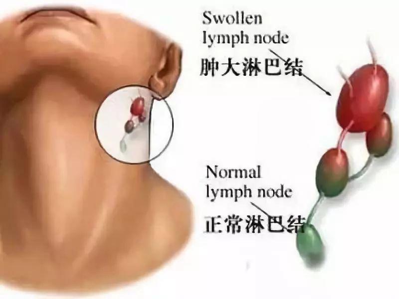 癌症中晚期补硒有用