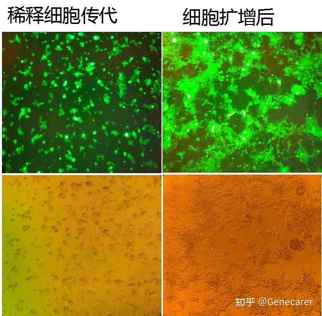 补硒能杀死肿瘤细胞