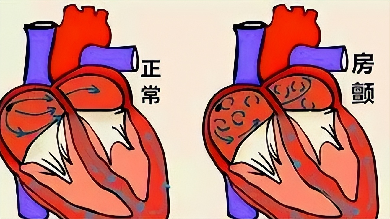 有补钙的针剂吗