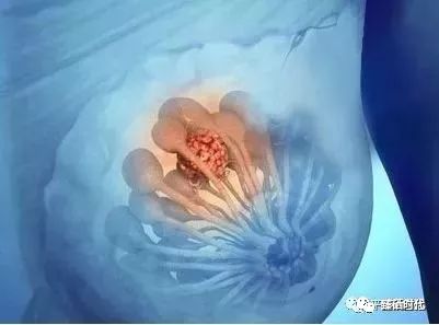 补硒对乳腺结节好吗