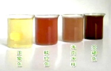 补硒小便什么颜色的