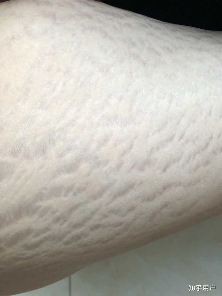 常吃药的人补点儿硒