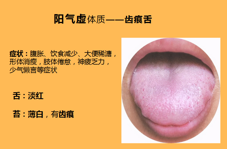 子宫肌瘤需要补硒嘛