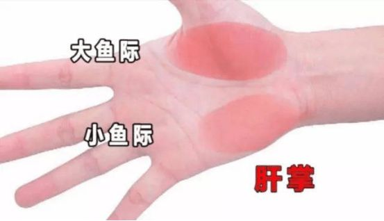肝硬化是否需要补硒