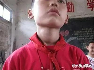 宝宝缺硒怎么补最快