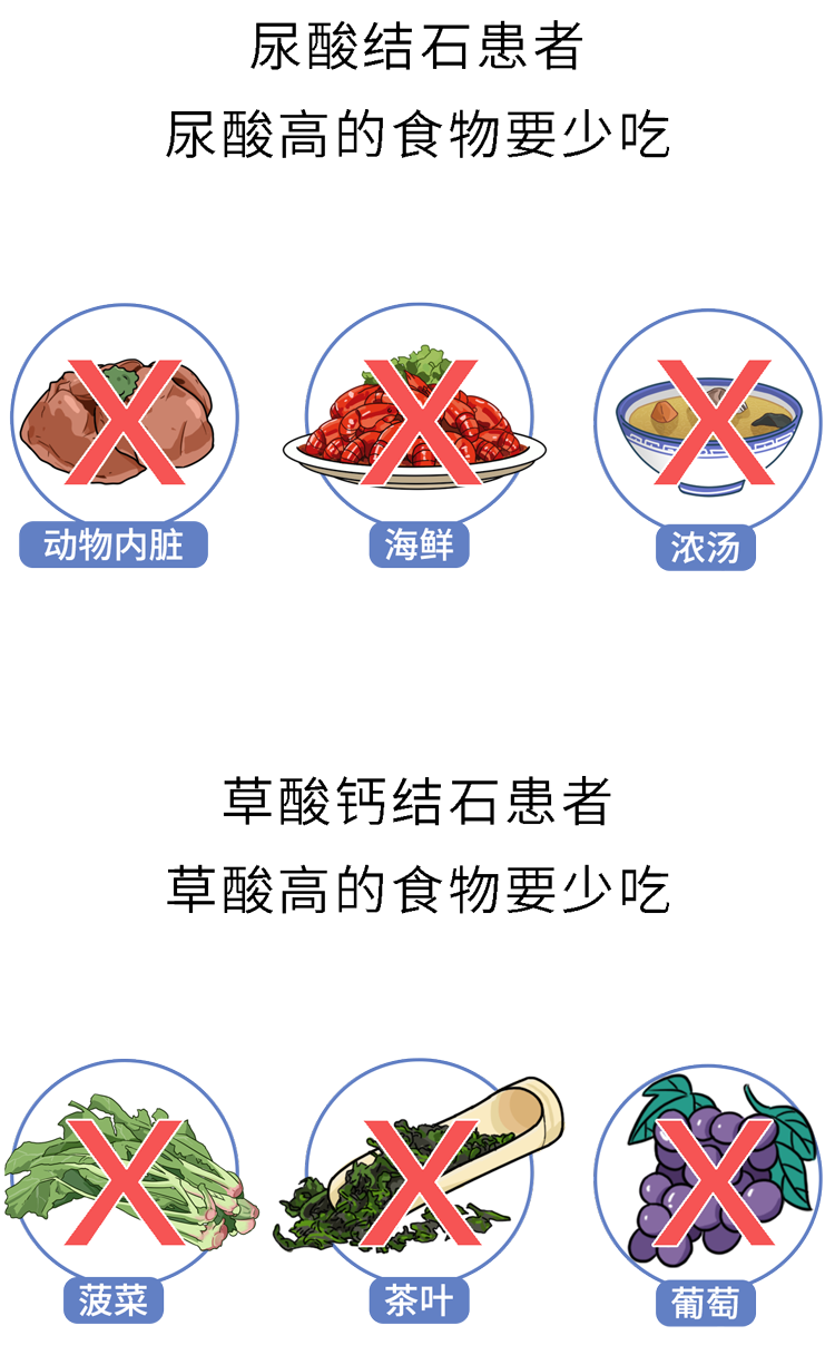 肾结石患者怎么补钙