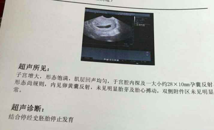 孕期补锌硒补到几周