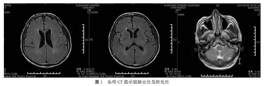 盐胶囊补钠口服用量