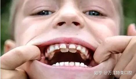 5岁小孩可以补硒吗