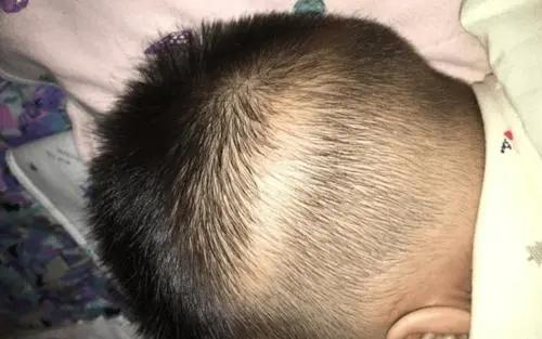 孩子补钙