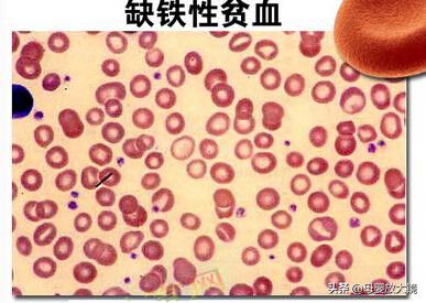 什么时候需要补硒呢
