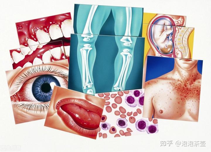 补钙最快的方法