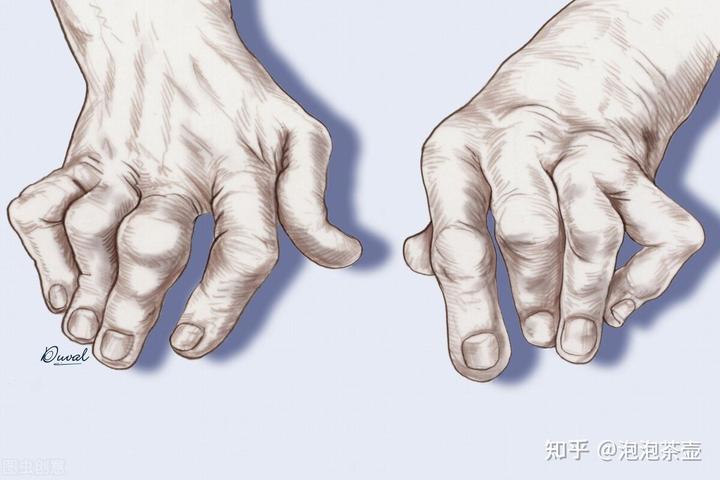 补钙最快的方法