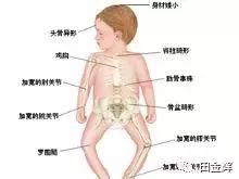 吃a d还用补硒吗