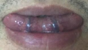 尿酸高男性能补硒吗