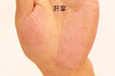 肝病可“写在”皮肤上，皮肤出现4个症状预示肝病来袭！