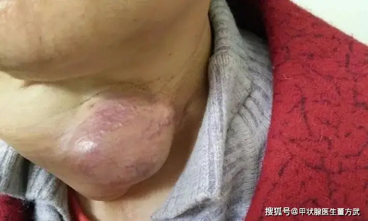 补碘食物