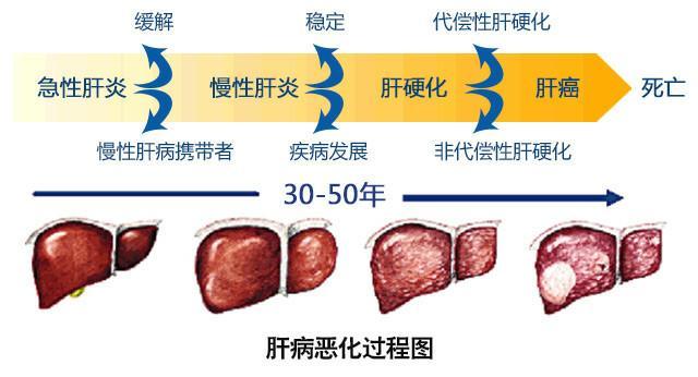 补硒能治疗肝硬化吗