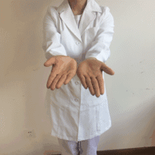 孩子微喘可以补硒吗