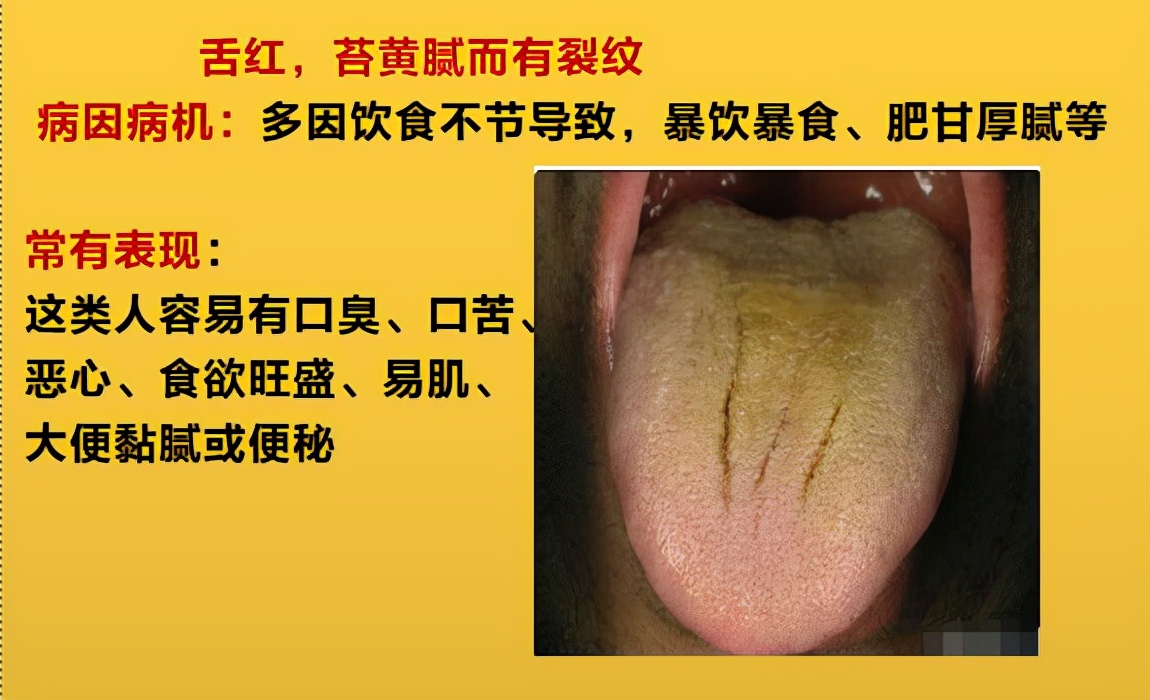有胃病的可以补硒吗