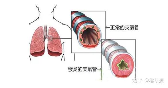 怎么提高免疫力补硒