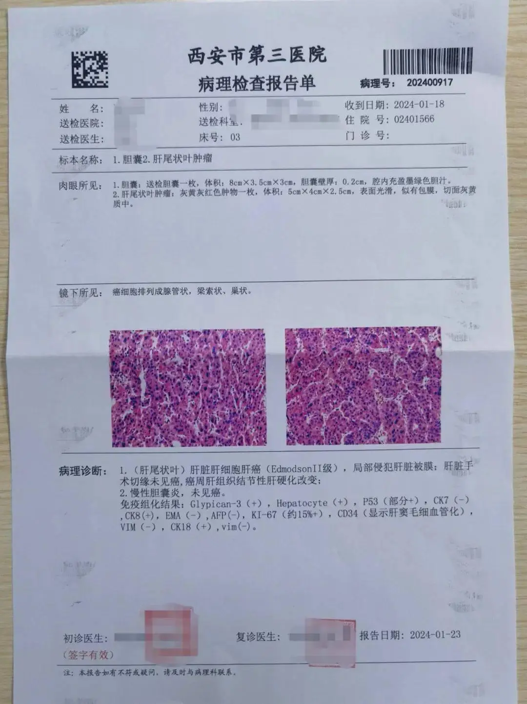 小细胞癌补硒有用不