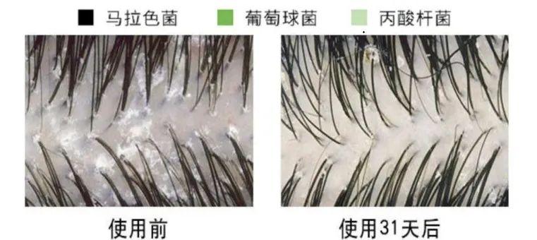 补哪款硒洗发水好呢