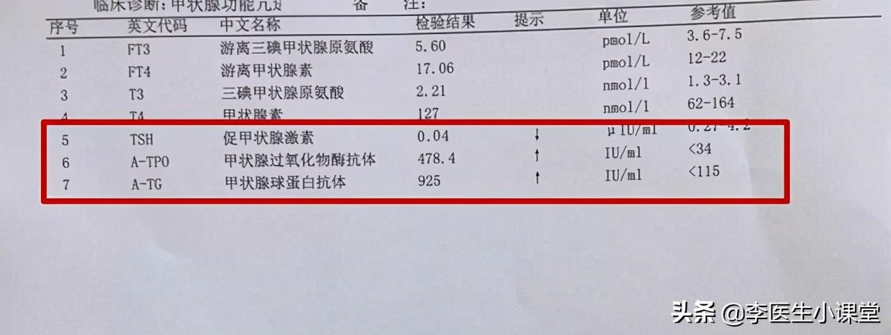 甲亢用补硒嘛有用吗