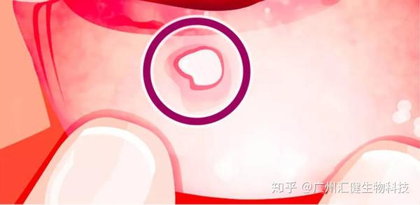 人体缺微量元素会出现什么症状