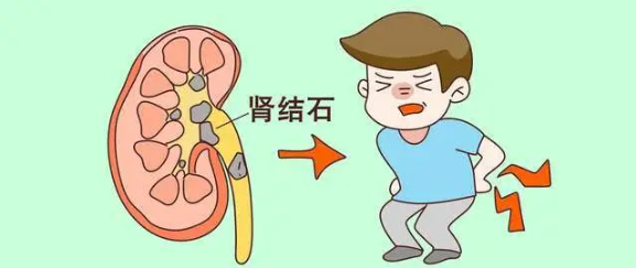 补钙过多
